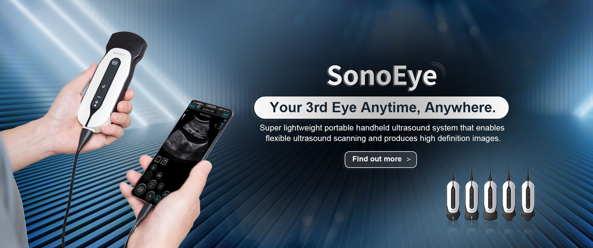 SonoEye