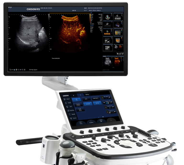 Adding Value to Your Contrast Ultrasound