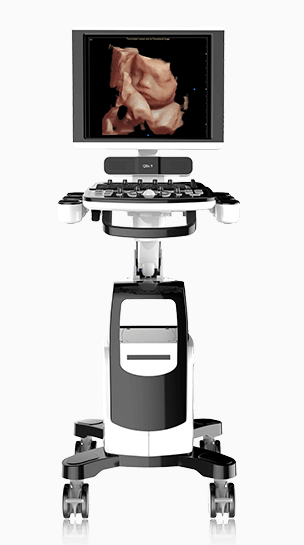 Cart-based Ultrasound 