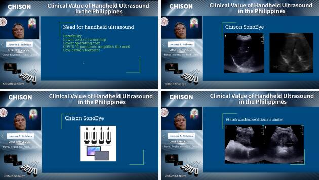 Clinical Value of Handheld Ultrasound in the Philippines