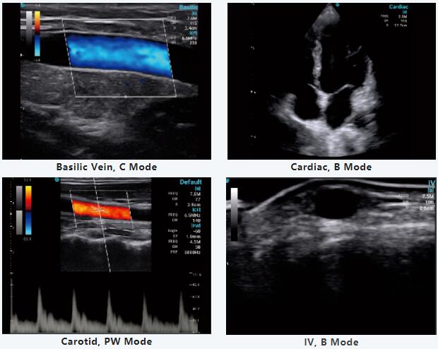 Clinical Value of Handheld Ultrasound in the Philippines