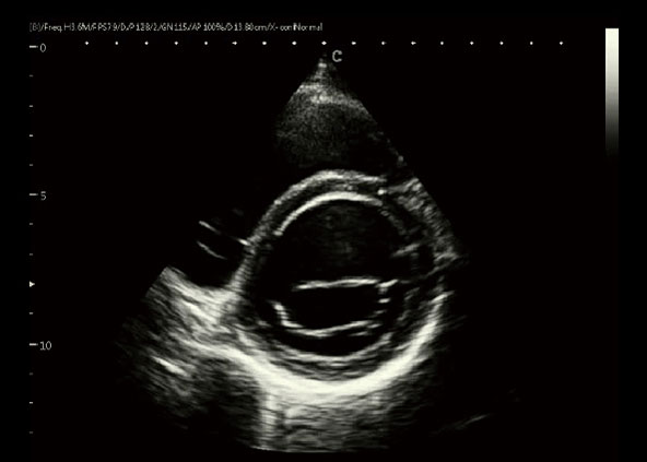 left ventricular short axis, B Mode