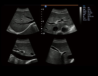 Abdomen, 4B Mode