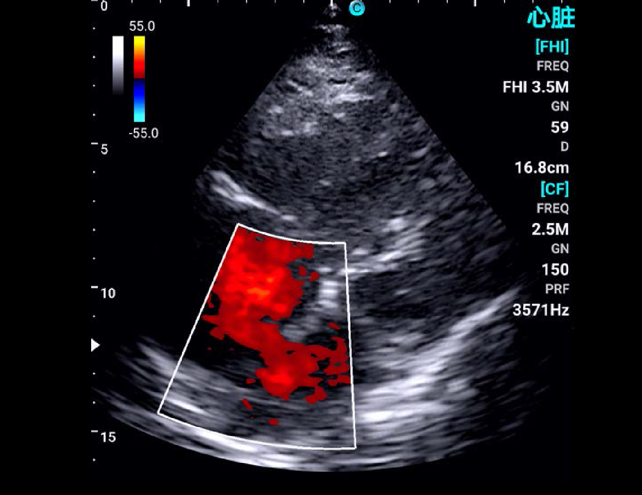 Cardiac, C Mode