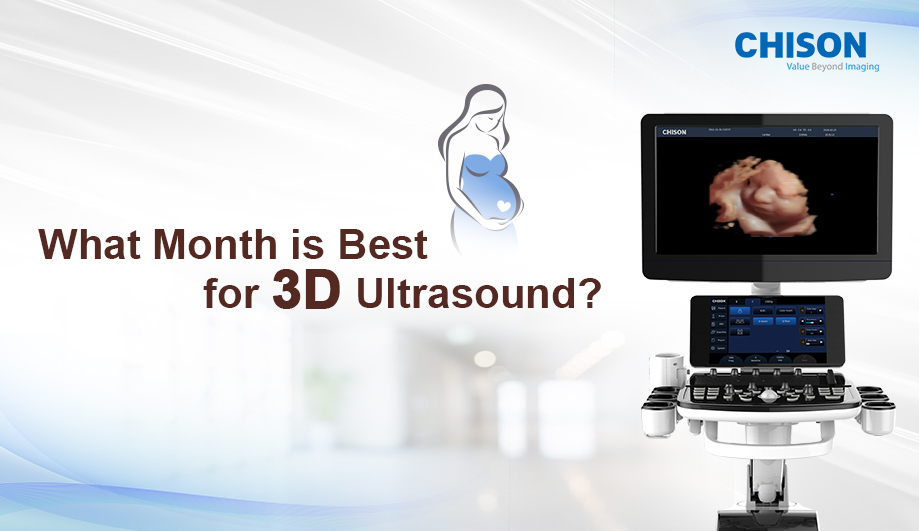What Month is Best for 3D Ultrasound?