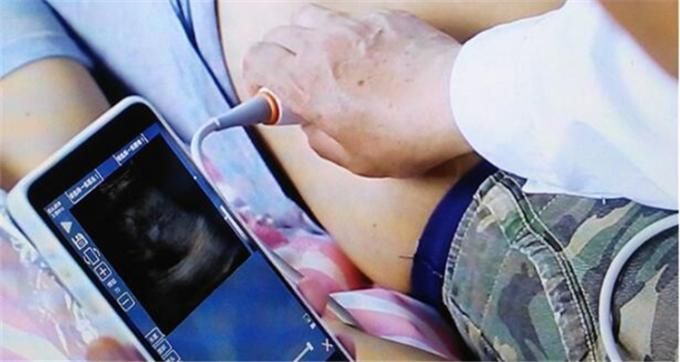 Anaesthetic imaging is key to patient safety and comfort, so make sure your ultrasound imaging system is reliable.