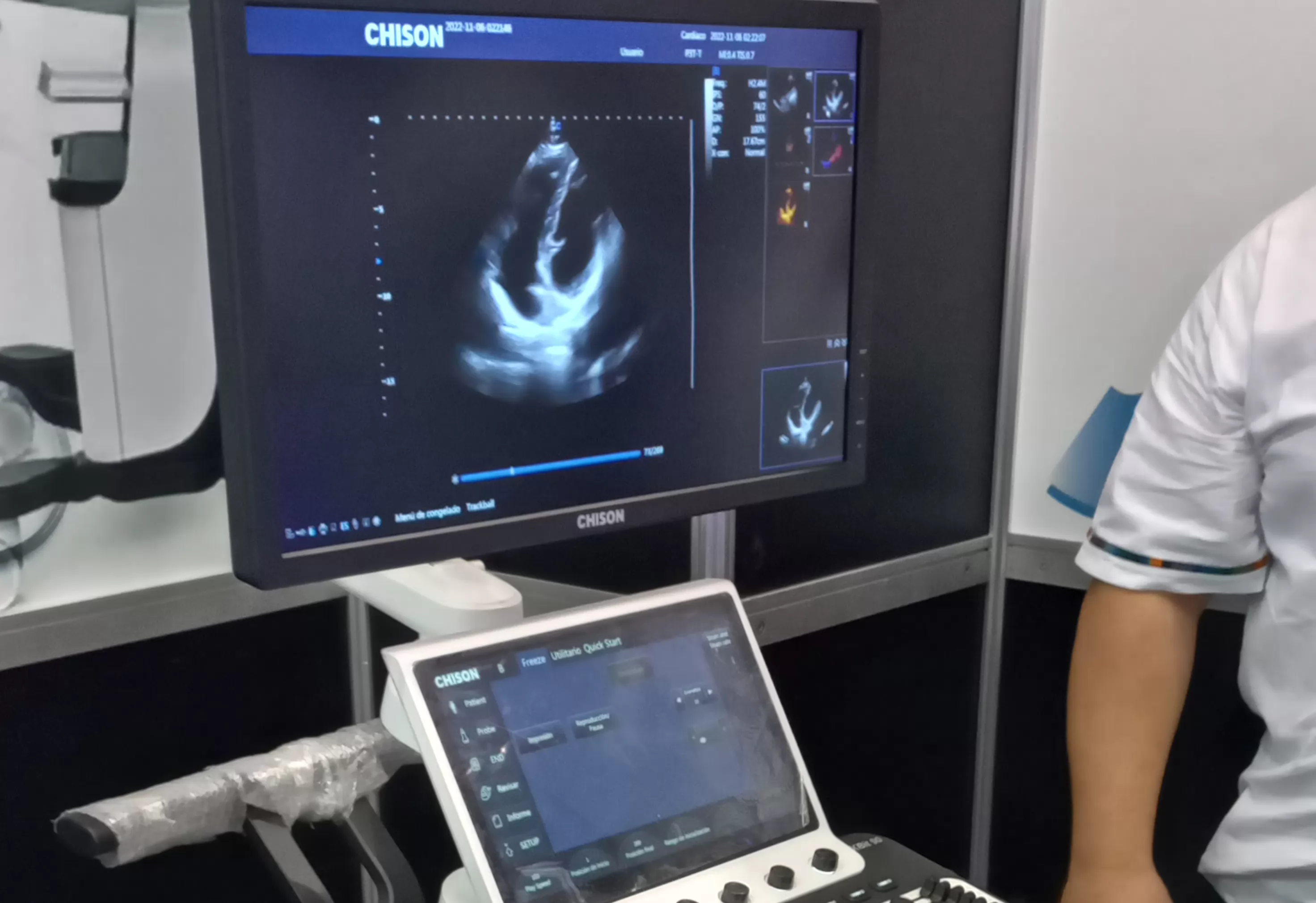 A wide range of cardiac department probes allows for scanning of every type of patient, and even pediatric and neonatal cardiology is seeing rapid growth in probes built for these small patients