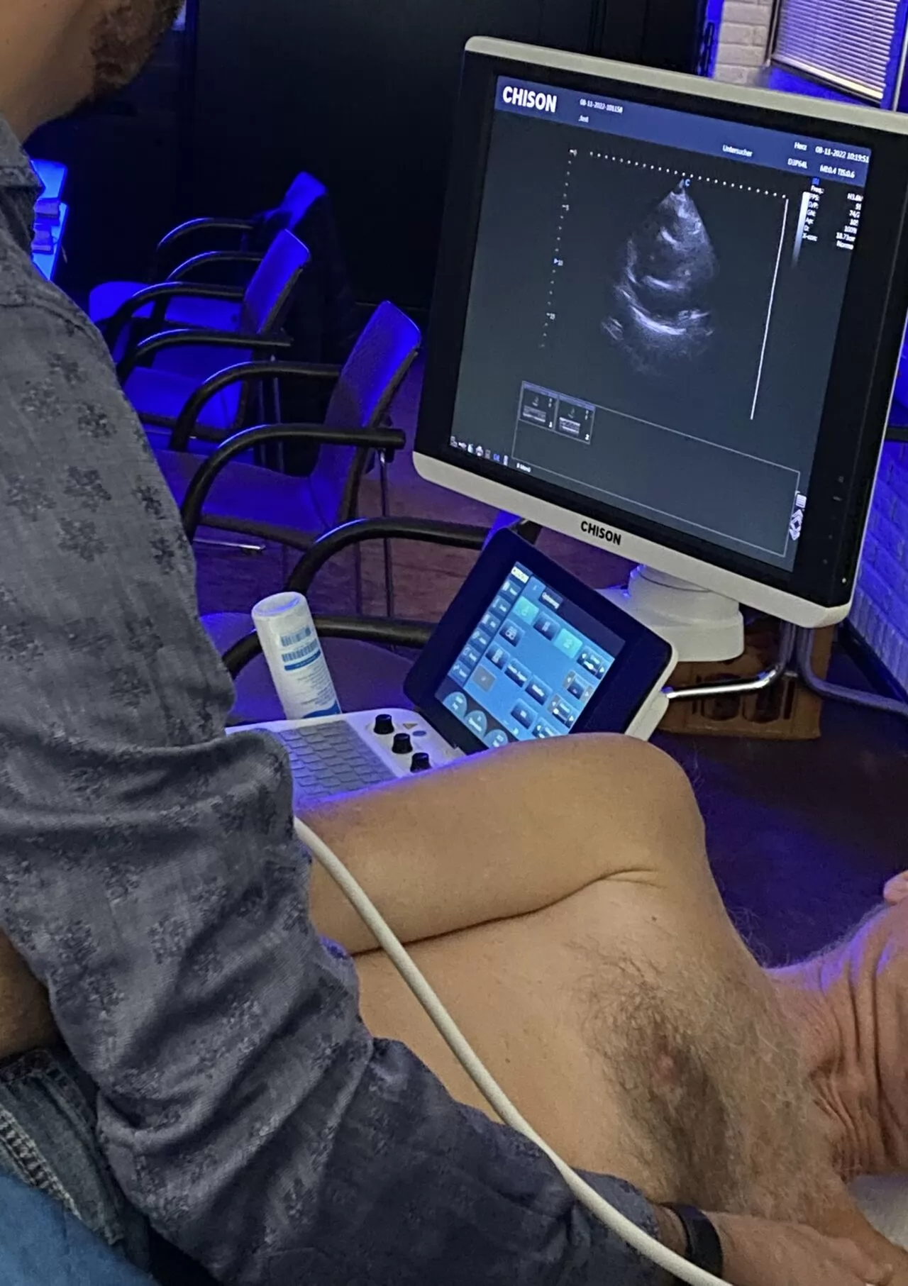 Cardiac ultrasound requires faster screen refreshes than any other application because of the need to accurately measure and visualize the movement of the beating heart.