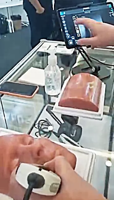 handheld ultrasound is used to guide the placement of dermal fillers. This is particularly useful in the treatment of deep wrinkles and facial contouring. The device can help the surgeon to accurately position the filler to achieve a natural-looking result. In addition, it allows the surgeon to avoid important structures such as nerves and blood vessels, reducing the risk of complications.