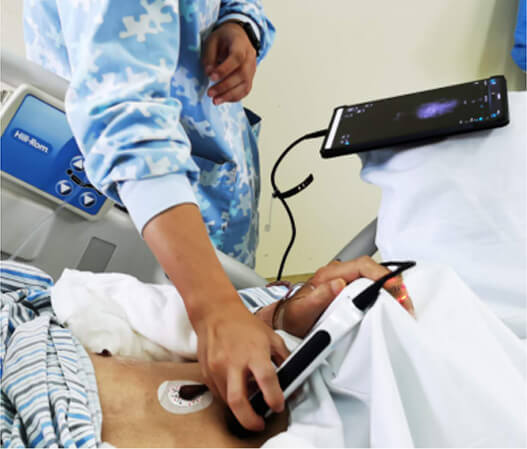 CHISON SonoEye in Asien CHISON SonoEye in Asien