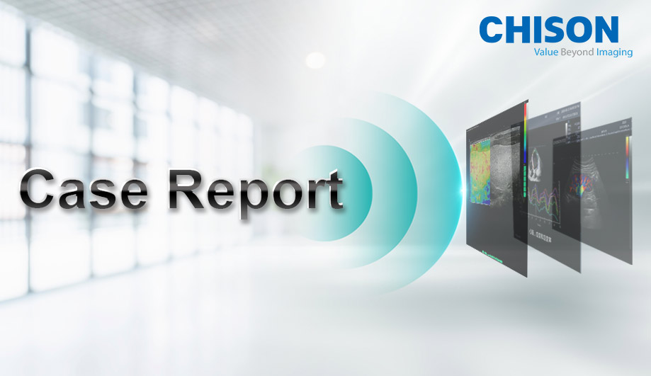 Ultrasound Guided Treatment of Scapulohumeral Periarthritis