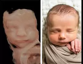 This makes it particularly useful in obstetrics and gynecology, as it allows for detailed visualization of the fetus and assessment of fetal growth and development. 