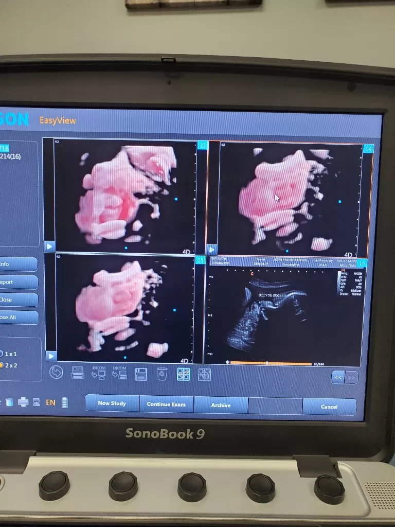 In addition to obstetrics and gynecology, 3D ultrasound is also used in a wide range of other medical fields, including abdominal imaging, breast imaging, cardiology, and prostate imaging. 